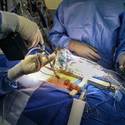 Spinal Fusion Surgery